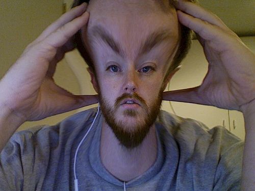 Big Headache